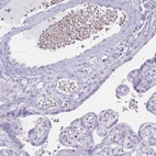 Immunohistochemical staining of human placenta shows weak cytoplasmic positivity in erythrocytes.