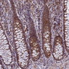 Immunohistochemical staining of human rectum strong nuclear-cytoplasmic positivity in glandular cells.