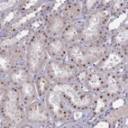Immunohistochemical staining of human kidney shows moderate nuclear-cytoplasmic positivity in cells in tubules.