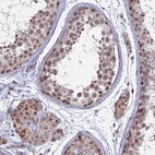 Immunohistochemical staining of human testis shows moderate nuclear-cytoplasmic positivity in cells in seminiferous ducts and Leydig cells.