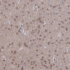 Immunohistochemical staining of human cerebral cortex shows moderate positivity in nuclear membrane in neuronal cells and cytoplasmic positivity in neuropil.