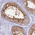 Immunohistochemical staining of human testis shows strong positivity in nuclear membrane/cytoplasm in cells in seminiferous ducts.