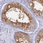 Immunohistochemical staining of human testis shows strong positivity in nuclear membrane/cytoplasm in cells in seminiferous ducts.
