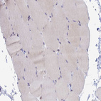 Immunohistochemical staining of human skeletal muscle shows negative positivity in myocytes.