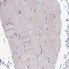 Immunohistochemical staining of human skeletal muscle shows negative positivity in myocytes.