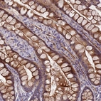 Immunohistochemical staining of human small intestine shows strong cytoplasmic-membranous positivity in goblet cells and glandular cells.