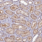 Immunohistochemical staining of human kidney shows moderate cytoplasmic-nucleus positivity in cells in tubules.