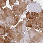 Immunohistochemical staining of human skeletal muscle shows strong cytoplasmic positivity in myocytes.