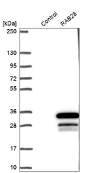 Western blot analysis in control (vector only transfected HEK293T lysate) and RAB28 over-expression lysate (Co-expressed with a C-terminal myc-DDK tag (~3.1 kDa) in mammalian HEK293T cells, LY422223).