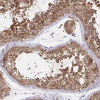 Immunohistochemical staining of human testis shows strong cytoplasmic-membranous positivity in cells in seminiferous ducts and leydig cells.