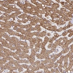 Immunohistochemical staining of human liver shows strong cytoplasmic-membranous positivity in hepatocytes.