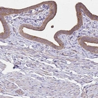 Immunohistochemical staining of human fallopian tube shows moderate cytoplasmic-membranous positivity in glandular cells.