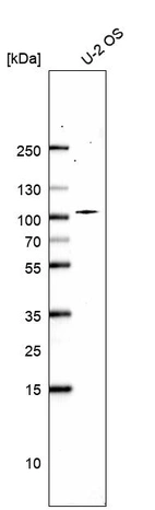 Western blot analysis in human cell line U-2 OS.