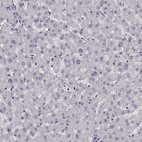 Immunohistochemical staining of human liver shows no positivity in hepatocytes as expected.