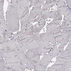 Immunohistochemical staining of human skeletal muscle shows no positivity in myocytes as expected.