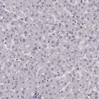 Immunohistochemical staining of human liver shows no positivity in hepatocytes as expected.