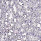 Immunohistochemical staining of human kidney shows no positivity in cells in tubules as expected.
