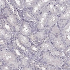 Immunohistochemical staining of human kidney shows no positivity in cells in tubules as expected.