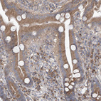 Immunohistochemical staining of human duodenum shows moderate cytoplasmic positivity in glandular cells.