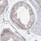 Immunohistochemical staining of human testis shows weak cytoplasmic/nuclear membranous positivity in cells in seminiferous ducts.
