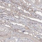 Immunohistochemical staining of human kidney shows weak cytoplasmic positivity in cells in tubules.