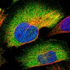 Immunofluorescent staining of human cell line U-251 MG shows localization to cytosol.