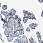 Immunohistochemical staining of human placenta shows no cytoplasmic positivity in trophoblastic cells as expected.