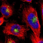 Immunofluorescent staining of human cell line U-251 MG shows localization to the Golgi apparatus & vesicles.