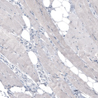 Immunohistochemical staining of human skeletal muscle shows no positivity in myocytes as expected.