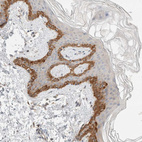 Immunohistochemical staining of human skin shows strong cytoplasmic positivity in melanocytes.