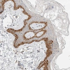 Immunohistochemical staining of human skin shows strong cytoplasmic positivity in melanocytes.
