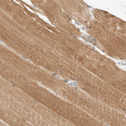 Immunohistochemical staining of human skeletal muscle shows moderate cytoplasmic positivity in myocytes.