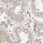 Immunohistochemical staining of human testis shows moderate cytoplasmic positivity in Leydig cells.