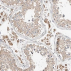 Immunohistochemical staining of human testis shows moderate cytoplasmic positivity in Leydig cells.