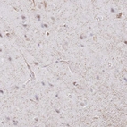 Immunohistochemical staining of human cerebral cortex shows moderate cytoplasmic positivity in neuropil.
