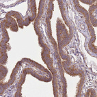 Immunohistochemical staining of human fallopian tube shows strong cytoplasmic positivity in glandular cells.