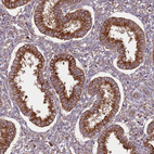 Immunohistochemical staining of human endometrium shows strong cytoplasmic positivity in glandular cells.