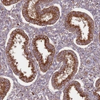 Immunohistochemical staining of human endometrium shows strong cytoplasmic positivity in glandular cells.