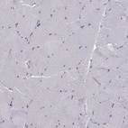 Immunohistochemical staining of human skeletal muscle shows no positivity in myocytes, as expected.