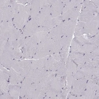 Immunohistochemical staining of human skeletal muscle shows no positivity in myocytes, as expected.