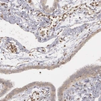 Immunohistochemical staining of human fallopian tube shows strong nuclear positivity in endothelial cells.