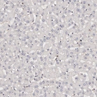 Immunohistochemical staining of human liver shows no positivity in hepatocytes, as expected.