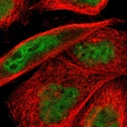 Immunofluorescent staining of human cell line A-431 shows localization to nucleoplasm.