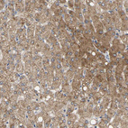 Immunohistochemical staining of human liver shows moderate cytoplasmic positivity in hepatocytes.