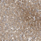 Immunohistochemical staining of human liver shows moderate cytoplasmic positivity in hepatocytes.