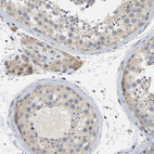 Immunohistochemical staining of human testis shows moderate positivity in Leydig cells.