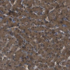 Immunohistochemical staining of human liver shows strong cytoplasmic positivity in hepatocytes.