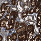 Immunohistochemical staining of human kidney shows strong cytoplasmic positivity in cells in tubules.