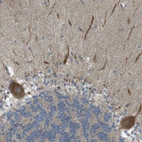 Immunohistochemical staining of human cerebellum shows strong cytoplasmic positivity in Purkinje cells.
