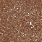 Immunohistochemical staining of human liver shows moderate cytoplasmic positivity in hepatocytes.